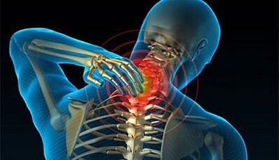 علائم پوکی استخوان ستون فقرات گردن رحم