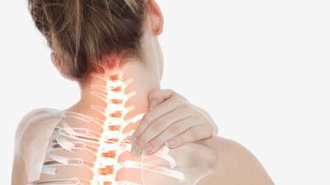 پوکی استخوان ستون فقرات گردن رحم