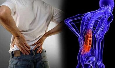 دلایل ایجاد پوکی استخوان کمری